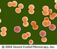 Prueba de laboratorio de meningitis realizada por  Dennis Kunkel