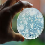 Meningococcal disease bacteria in petri dish